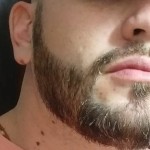 edrgloco