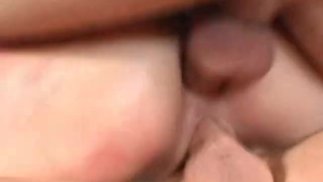 DP