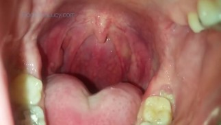 Tongue