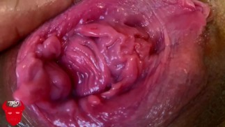 TMD: Prolapsed Pussy Fisting!