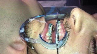 Éjacule sur les bretelles Headgear