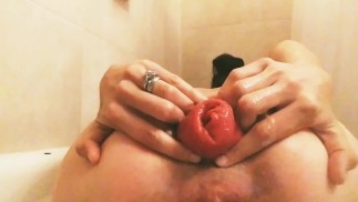 Prolasso anale gape