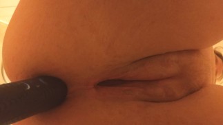 Post op, cum dripping