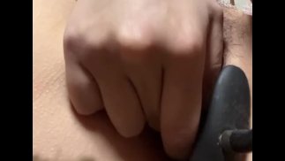 Inserimento della pompa anale