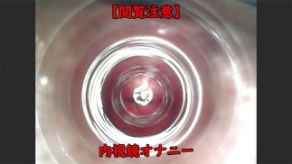 Masturbazione uretrale usando un endoscopio.