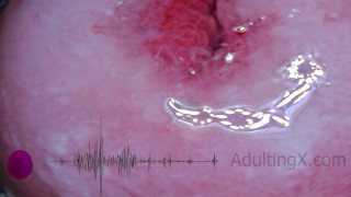 Cervix Pulse Puls Pulsation Orgasmes EKG - Sophie Adulte
