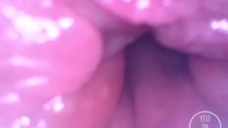 POV Exame 📷🍑 anal extremo e profundo - visualização