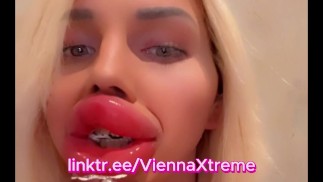 公共の場で最も極端に腫れたビンボ偽のボトックスリップス|Vienna Xtreme