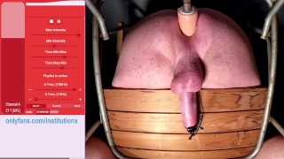 SPERMAABSAUGUNG AUF DEM AUFSPIEHLSTUHL