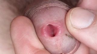 Primo piano di un'uretra spalancata